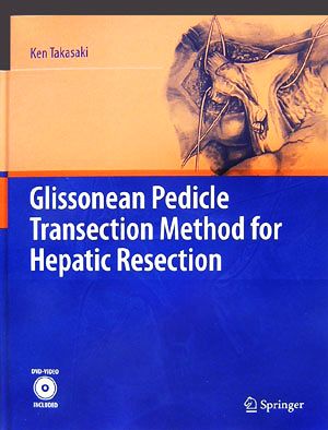 Glissonean Pedicle Transection Method for Hepatic Resection