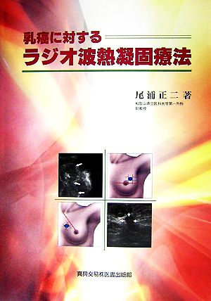 乳癌に対するラジオ波熱凝固療法