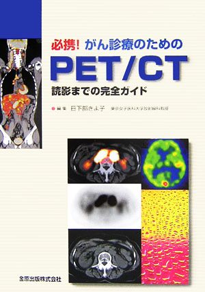 必携！がん診療のためのPET/CT読影までの完全ガイド