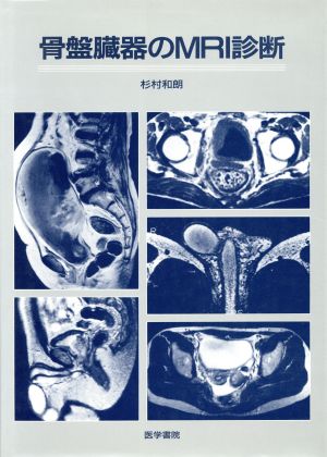 骨盤臓器のMRI診断