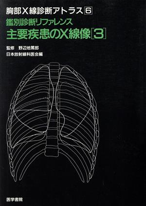 鑑別診断リファレンス 主要疾患のX線像(3) 胸部X線診断アトラス6