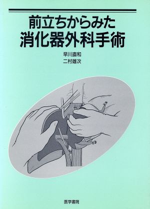 前立ちからみた消化器外科手術