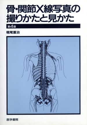 骨・間接X線写真の撮りかたと見かた