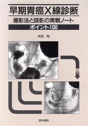 早期胃癌X線診断 撮影法と読影の実戦ノート ポイント100