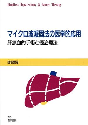 マイクロ波凝固法の医学的応用 肝無血的手術と癌治療法