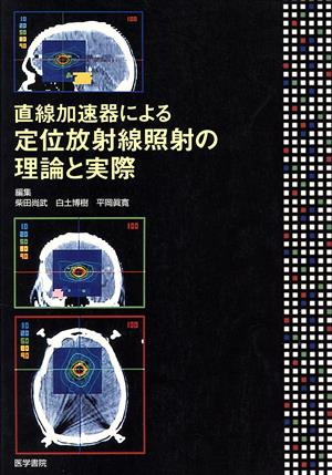 直線加速器による定位放射線照射の理論と実