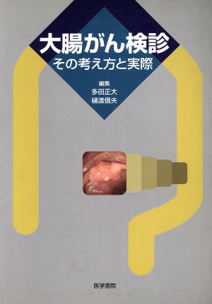 大腸がん検診-その考え方と実際