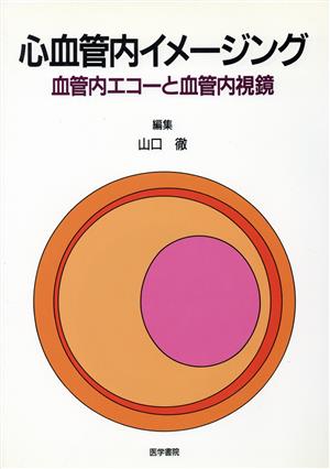 心血管内イメージング 血管内エコーと血管内視鏡