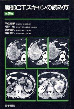 腹部CTスキャンの読み方 第2版