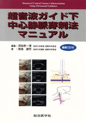 超音波ガイド下 中心静脈穿刺法マニュアル