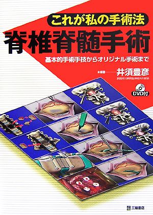 これが私の手術法 脊椎脊髄手術 基本的手術手技からオリジナル手術まで