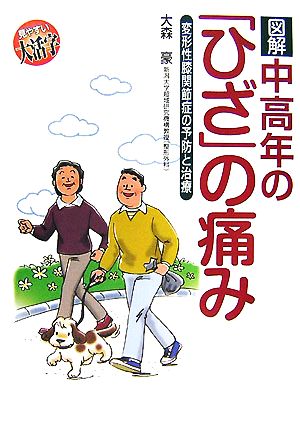 図解 中高年の「ひざ」の痛み 変形性膝関節症の予防と治療