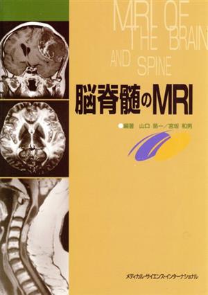 脳脊髄のMRI