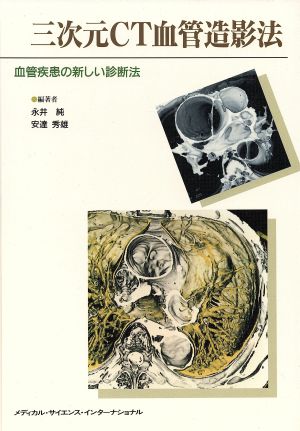 三次元CT血管造影法 血管疾患の新しい診