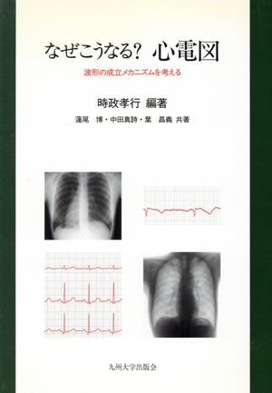 なぜこうなる？心電図波形の成立メカニズムを考える