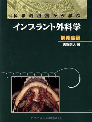 科学的根拠から学ぶインプラント 偶発症編