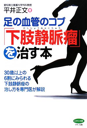 足の血管のコブ「下肢静脈瘤」を治す本 ビタミン文庫