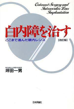 白内障を治す 改訂版ここまで進んだ眼内レンズ