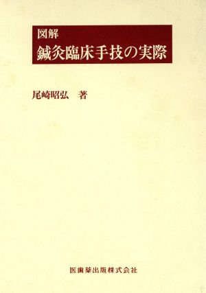 図解 鍼灸臨床手技の実際 中古本・書籍 | ブックオフ公式オンラインストア