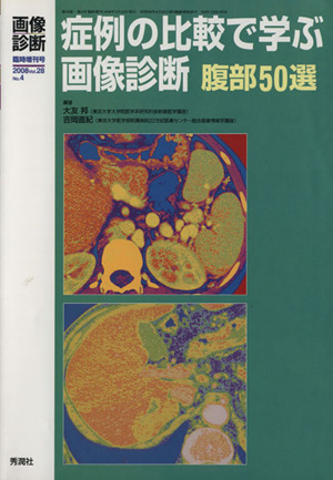 症例の比較で学ぶ画像診断 腹部50選 画像診断臨時増刊号2008vol.28No.4