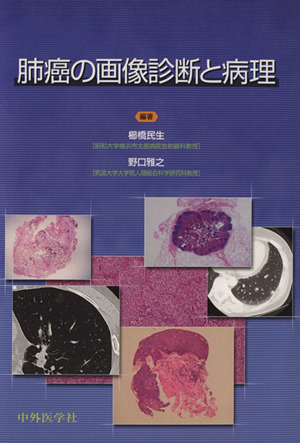 肺癌の画像診断と病理