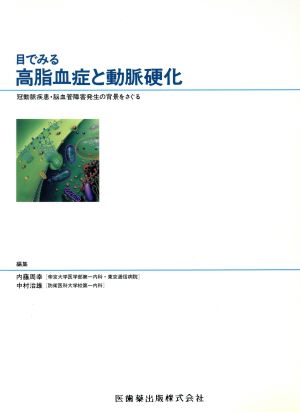 目でみる高脂血症と動脈硬化