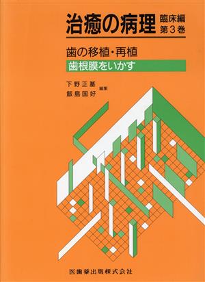 歯の移植・再植