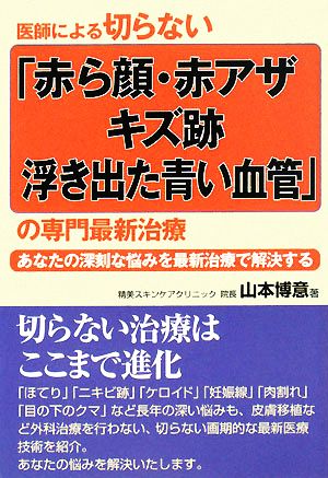 医師による切らない「赤ら顔・赤アザ・キズ跡・浮き出た青い血管」の専門最新治療 あなたの深刻な悩みを最新治療で解決する