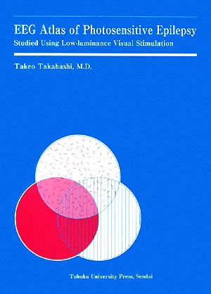 EGG Atlas of Photosensitive Epilepsy:Studied Using Low-luminance Visual Stimulation