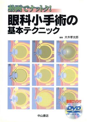 動画でナットク！眼科小手術の基本テクニッ