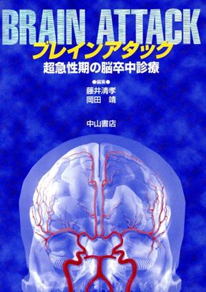 ブレインアタック 超急性期の脳卒中診療