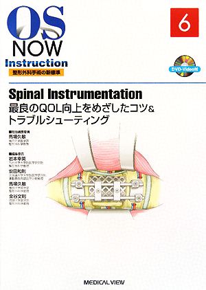 Spinal Instrumentation 最良のQOL向上をめざしたコツ&トラブルシューティング OS NOW Instruction整形外科手術の新標準6