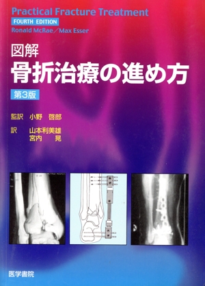図解 骨折治療の進め方 第3版