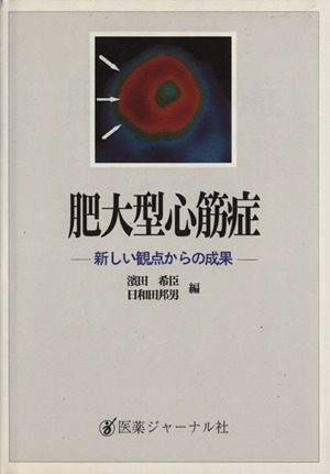 肥大型心筋症-新しい観点からの成果-