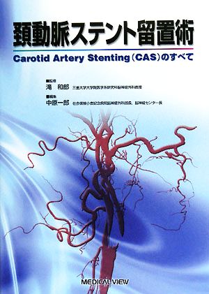頚動脈ステント留置術Carotid Artery Stentingのすべて