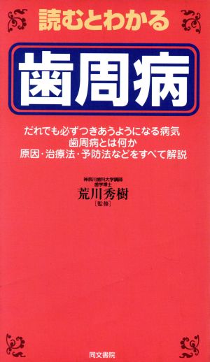 読むとわかる 歯周病