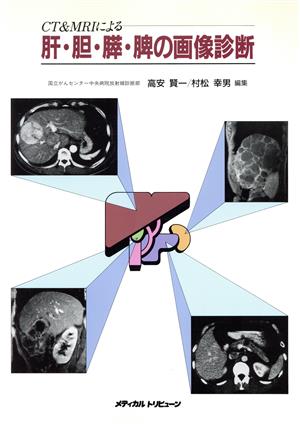 肝胆膵脾の画像診断