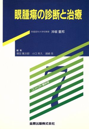 眼腫瘍の診断と治療