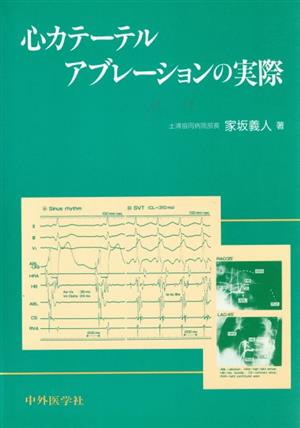 心カテーテルアブレーションの実際