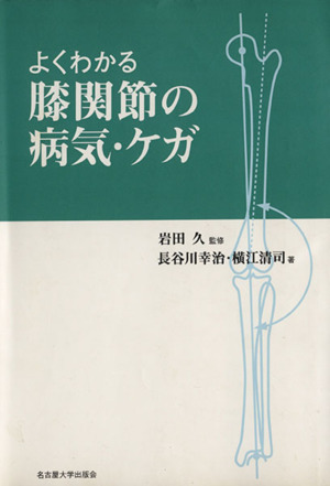 よくわかる膝関節の病気・ケガ