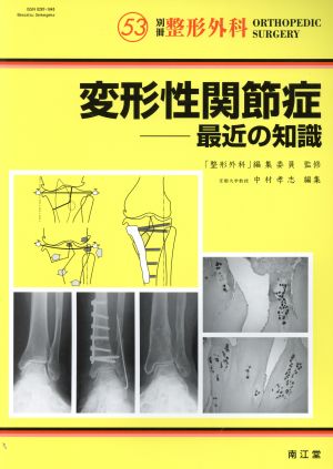 変形性関節症-最近の知識