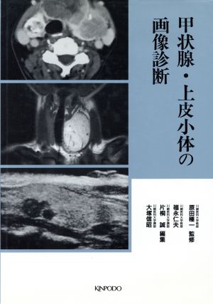 甲状腺・上皮小体の画像診断