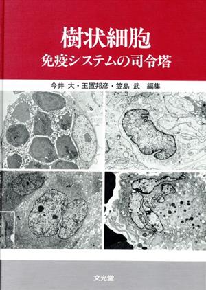 樹状細胞 免疫システムの司令塔