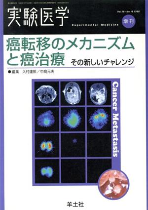 癌転移のメカニズムと癌治療 その新しいチ