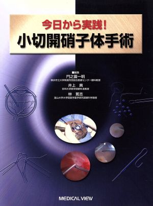 今日から実践！小切開硝子体手術