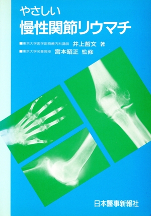 やさしい慢性関節リウマチ