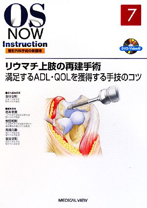 リウマチ上肢の再建手術 満足するADL・QOLを獲得する手技のコツ OS NOW Instruction整形外科手術の新標準7