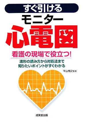 すぐ引けるモニター心電図 看護の現場で役立つ！波形の読み方から対処法まで知りたいポイントがすぐわかる