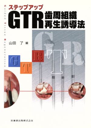 ステップアップGTR-歯周組織再生誘導法