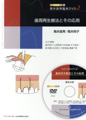 歯周再生療法とその応用 筒井昌秀臨床DVD 2 DVDジャーナル2